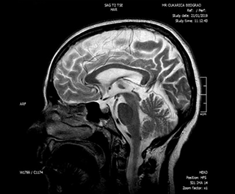 magnetna rezonanca glave beograd