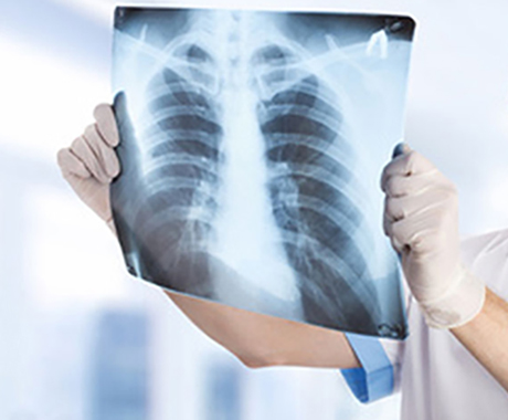 pregled pulmologa beograd
